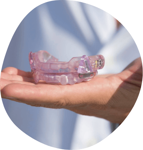 Person holding a light purple oral appliance for sleep apnea in their hand